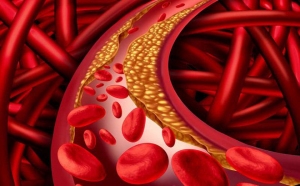 Tỏi đen - Kiểm soát đường huyết và rối loạn mỡ máu